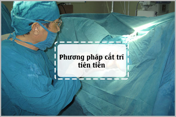 CẮT TRĨ KHÔNG ĐAU VÀ AN TOÀN TẠI ĐA KHOA 23/10 NHA TRANG